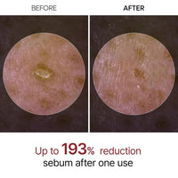 Rice Peel Shot Ampoule™